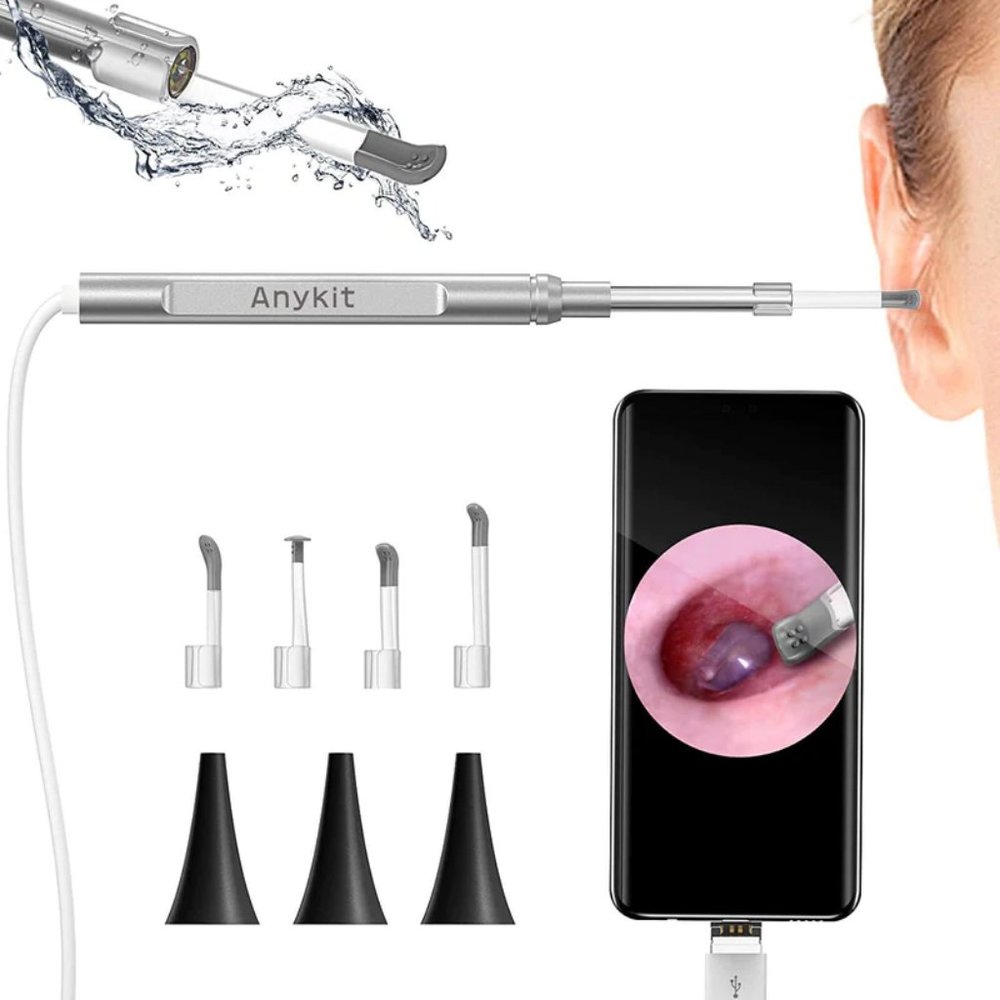 USB Otoscope Camera